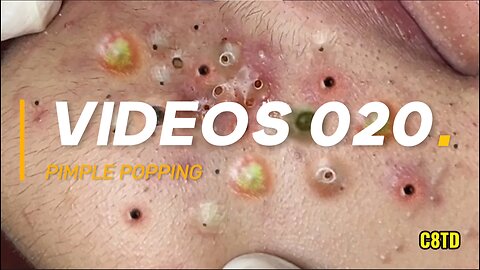 Satisfying Pimple Popping Videos 020