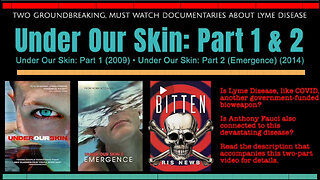 'Under Our Skin' MOVIE "The Terrifying Real Life Drama & Medical Controversy Of 'Lyme' Disease"