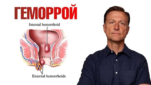 Лучшее натуральное средство от геморроя - Доктор Берг