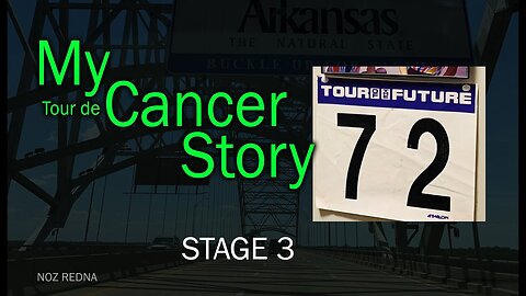 My (tour de) Cancer Story - Stage 3 (Surgery... again)