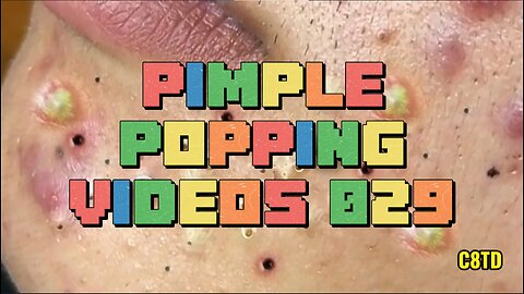 Satisfying Pimple Popping Videos 029