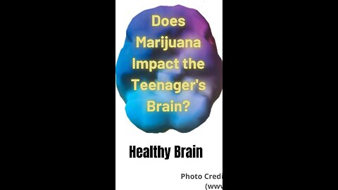 Marijuana & the Teenage Brain