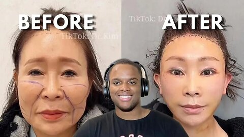 TikTok Surgeon DR. Kim Is INSANE