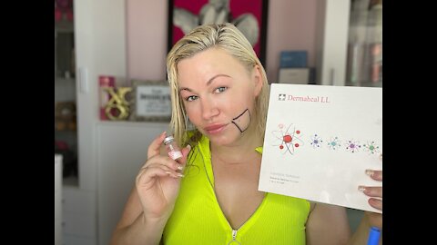 Dissolving my Jowl Fat with Dermaheal LL round 2 | Code Jessica10 saves you $$$