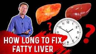 How Long Does It Take to Fix Fatty Liver? – Dr. Berg