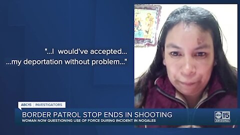 Woman allegedly shot in the head by a Border Patrol agent speaks out