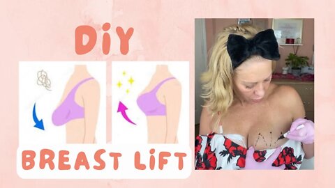 DIY BREAST LIFT - SASSY10