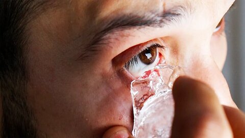What happens if you put ICE on your EYEBALLS?