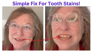 Simple Fix for Tooth Stains