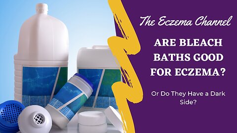 Are Bleach Baths Good for Eczema?