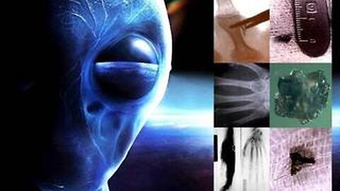 Alien Implants, The Mark of the Beast, Anti-Christ Entities and Corporations