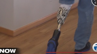 Amputee fitted with new prosthetic leg