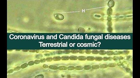Origin of new emergent Coronavirus and Candida fungal diseases—Terrestrial or cosmic?