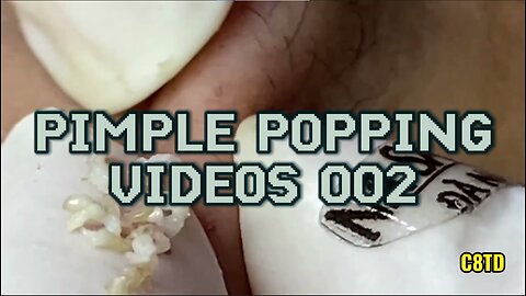 Satisfying Pimple Popping Videos 002