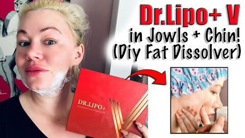 DIY Fat Dissolver in my Chin and Jowls, Dr.Lipo+V from www.acecosm.com | Code Jessica10 Saves You $