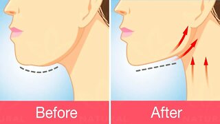 Get Rid of Double Chins With This Exercise and Natural Treatment