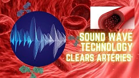 Using Sound Waves Clear The Arteries || Increase Blood Flow With Sound