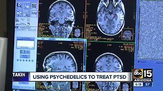 Using psychedelics to treat depression