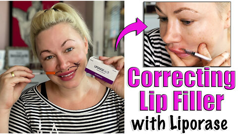 Correcting Lip Filler with Liporase from Acecosm.com | Code Jessica10 Saves you Money!