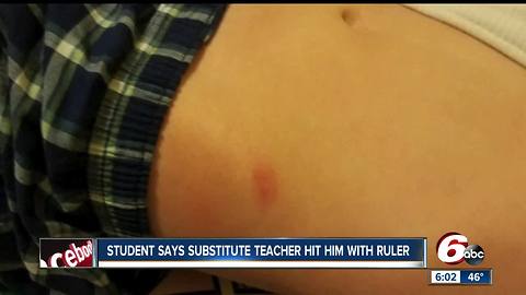 Third grader tells his mother that red mark was caused by substitute teacher who hit him with a ruler