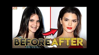 Kendall Jenner Glow Up 2019 | Before and After Transformations | KUWTK