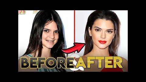 Kendall Jenner Glow Up 2019 | Before and After Transformations | KUWTK