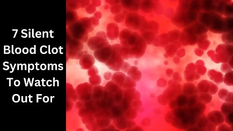 7 Blood Clot Symptoms To Watchout For