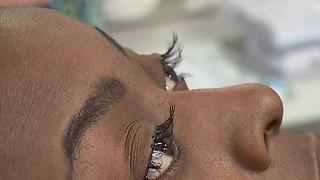 Eyelash extensions leave woman with infection