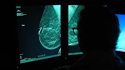 Same-day mammogram results now available