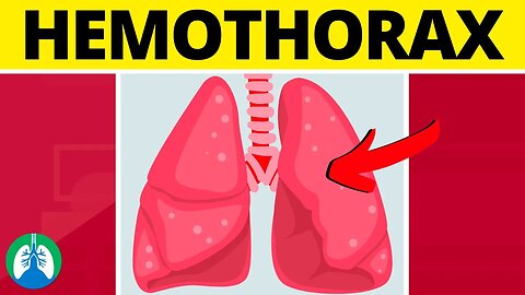 Hemothorax (Medical Definition) | Quick Explainer Video