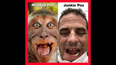 🙉"THIS MONKEYPOX SH*T AIN'T NO JOKE"🙊"MAN GOES BANANAS AFTER CONTRACTING MONKEYPOX"🙈