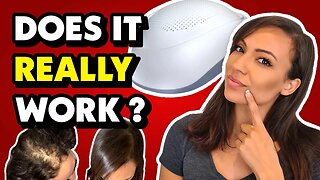 DOES LASER LIGHT THERAPY REALLY WORK ON HAIR LOSS? *unsponsored review