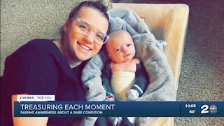 Sand Springs mother raising awareness about son's rare medical condition