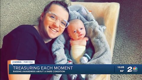 Sand Springs mother raising awareness about son's rare medical condition