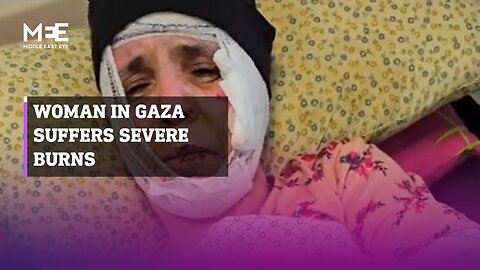 Woman in Gaza severely burned in Israeli air strike