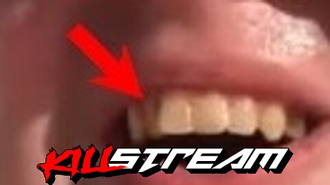 KILLSTREAM: PPP's ROTTEN TEETH, TRUMP BAILOUT, + CEASEFIRE PASSES at UN