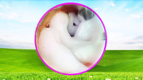 Earwax Extraction Relaxing with Flute Music #02