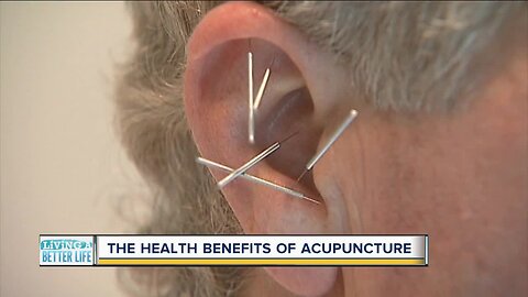 The health benefits of acupuncture