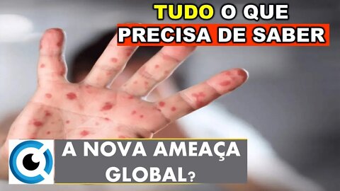 MONKEYPOX - O QUE É A VARIOLA DO MACACO