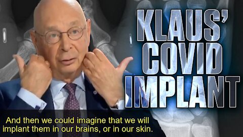 Klaus Schwab Plans To Implant Us With Microchips!