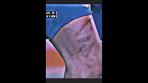 Messi insane dribbling while injured (short video)