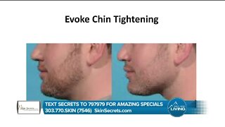 Evoke Chin Tightening // Skin Secrets