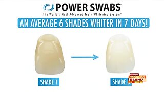 The World's Most Advanced Teeth Whitening System