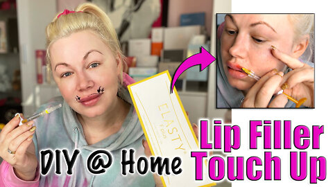 DIY AT Home Lip Filler Touch up with Elasty Fine from www.acecosm.com | Code Jessica10 Saves you $$$