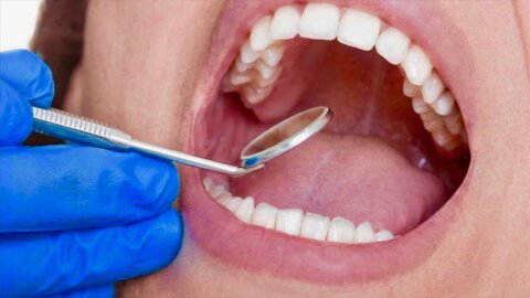 No More Cavities -New Drug Regenerates And Regrows Teeth! - Heals Cavities - No More Drill