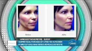 Ageless Expressions MedSpa - Learn about the Vampire Facelift and Facial