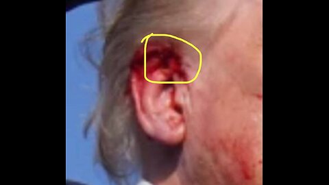 Donald Trump Is Safe After Assassination Attempt