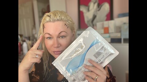 LIVE! Rejuvenate hairline with PLLA THREADS from acecosm.com - code Jessica10 saves you 10% off