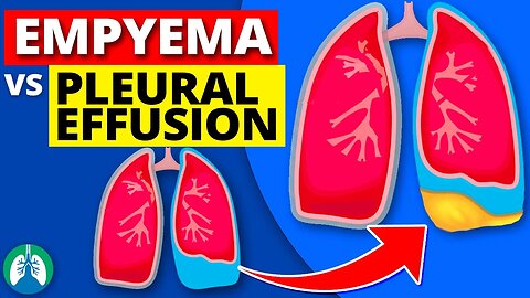Empyema vs. Pleural Effusion *EXPLAINED*