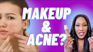 Can You Wear Makeup If You Have Acne? What’s the Best Kind? A Doctor Explains